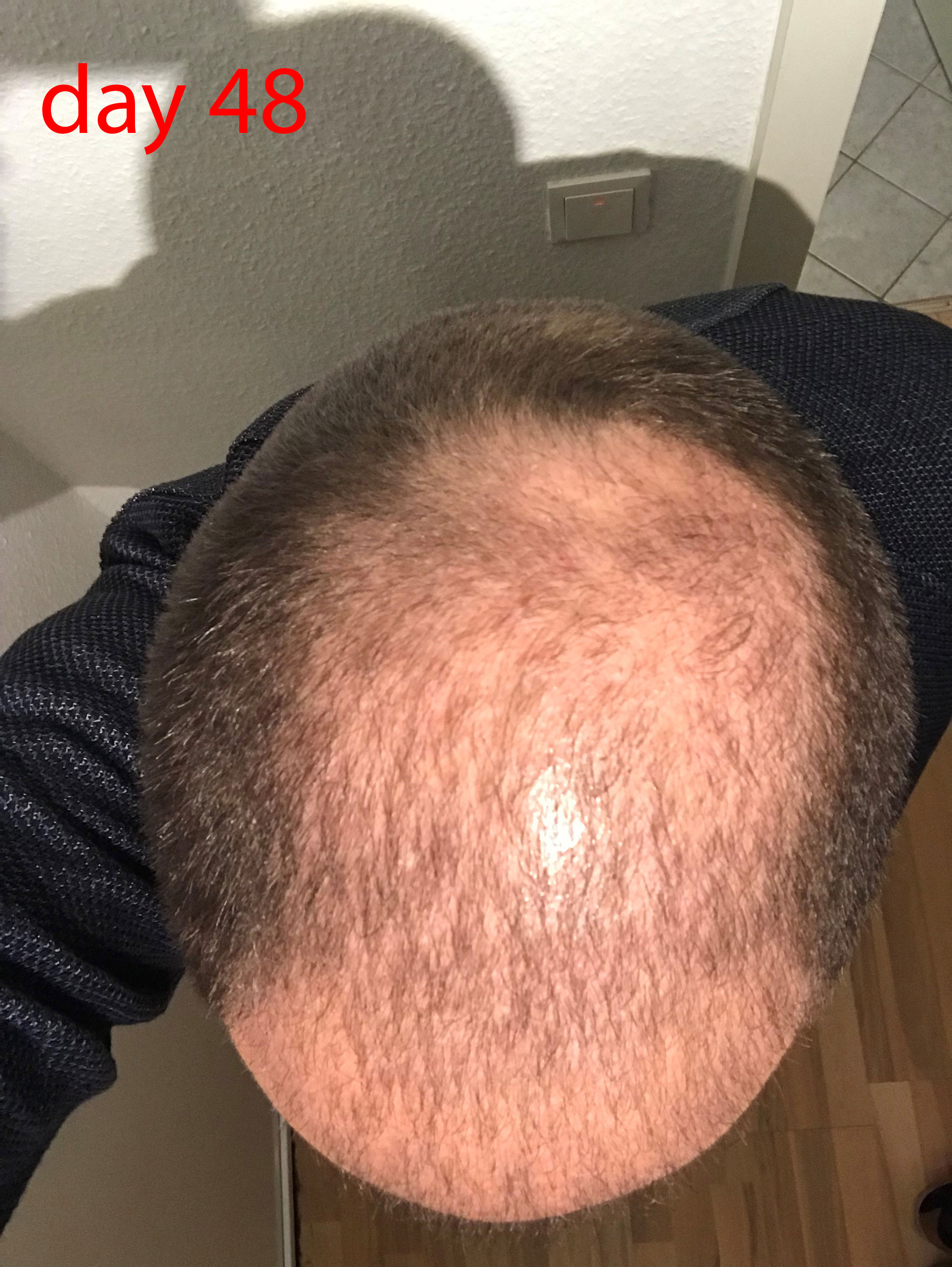 /foren/transplant/index.php/fa/40693/0/