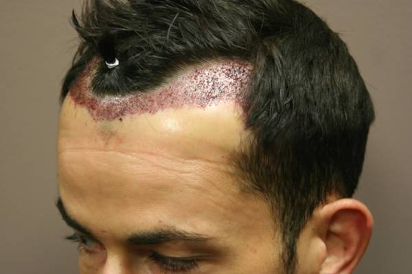 index.php/fa/4071/0/