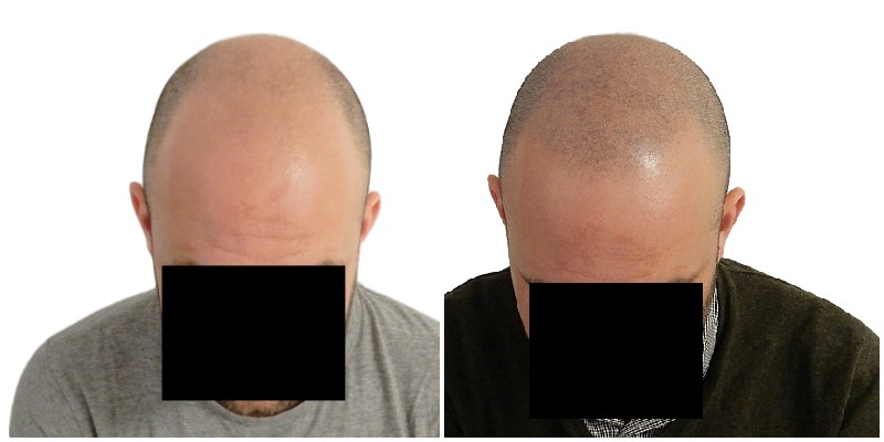 /foren/transplant/index.php/fa/40716/0/