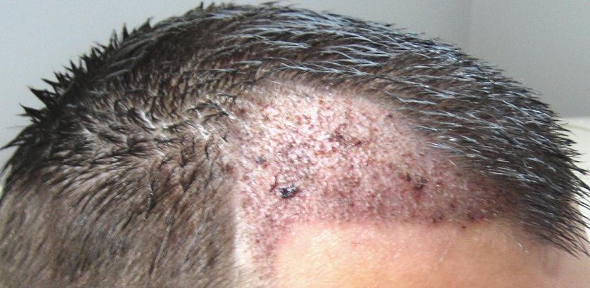 index.php/fa/4072/0/