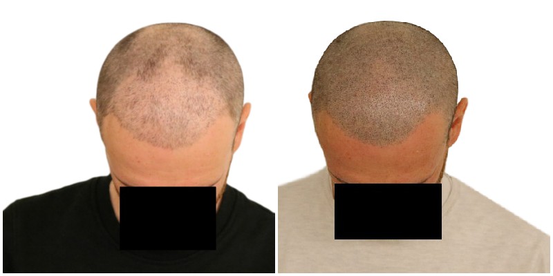 /foren/transplant/index.php/fa/40733/0/