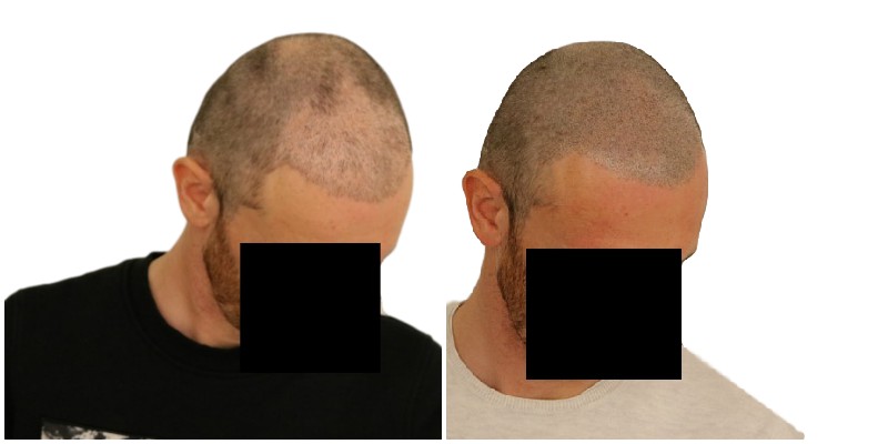 /foren/transplant/index.php/fa/40742/0/