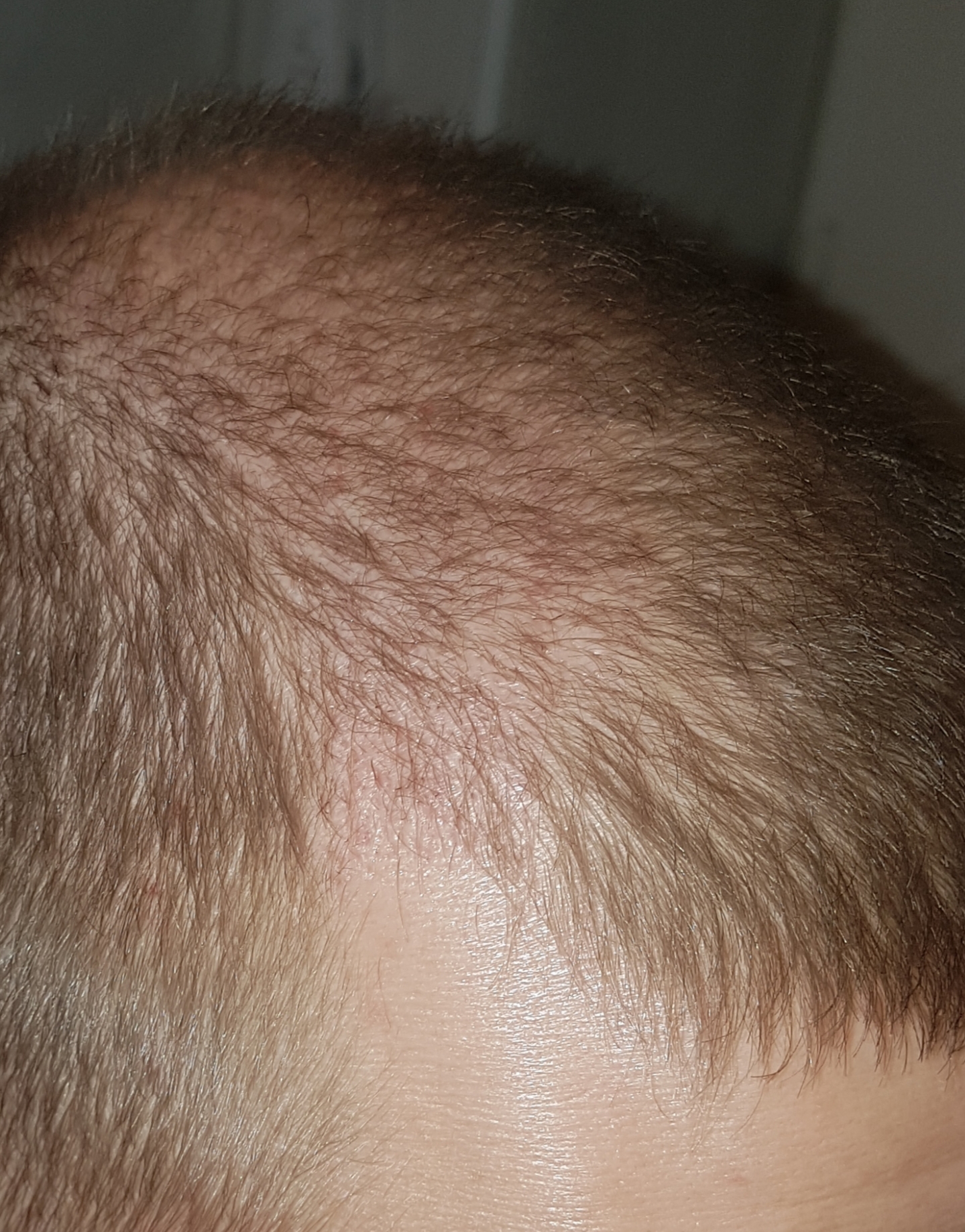 /foren/transplant/index.php/fa/40746/0/