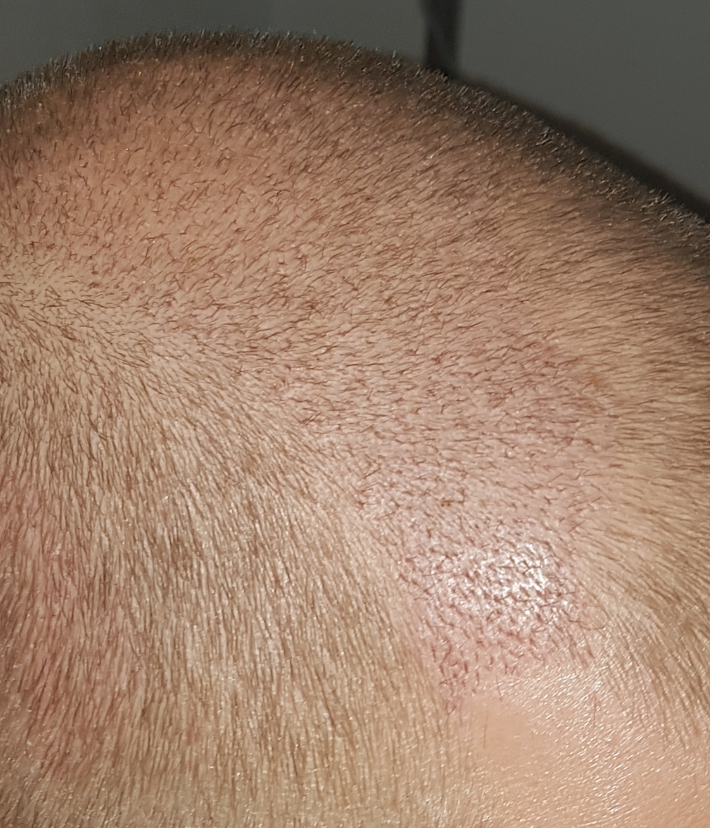 /foren/transplant/index.php/fa/40747/0/