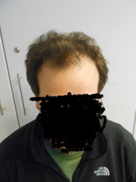 /foren/transplant/index.php/fa/40966/0/