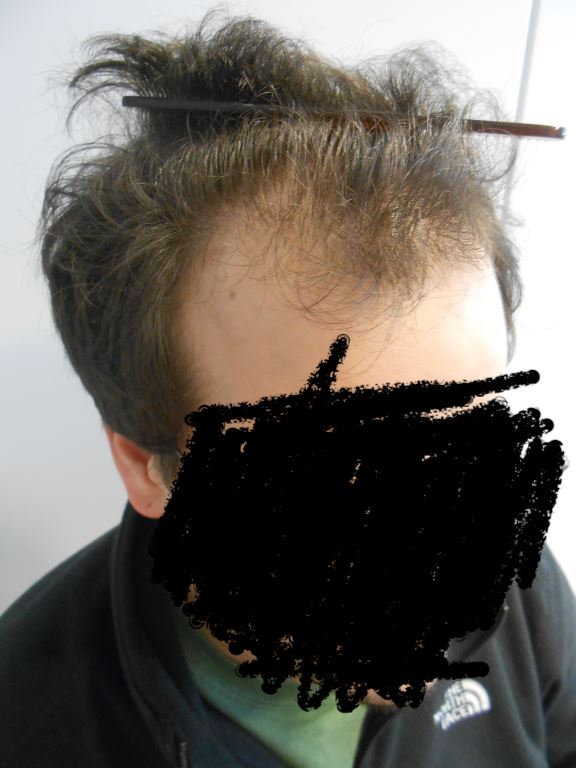 /foren/transplant/index.php/fa/40967/0/