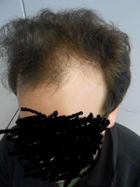 /foren/transplant/index.php/fa/40968/0/