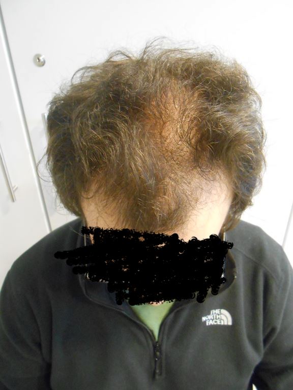 /foren/transplant/index.php/fa/40969/0/