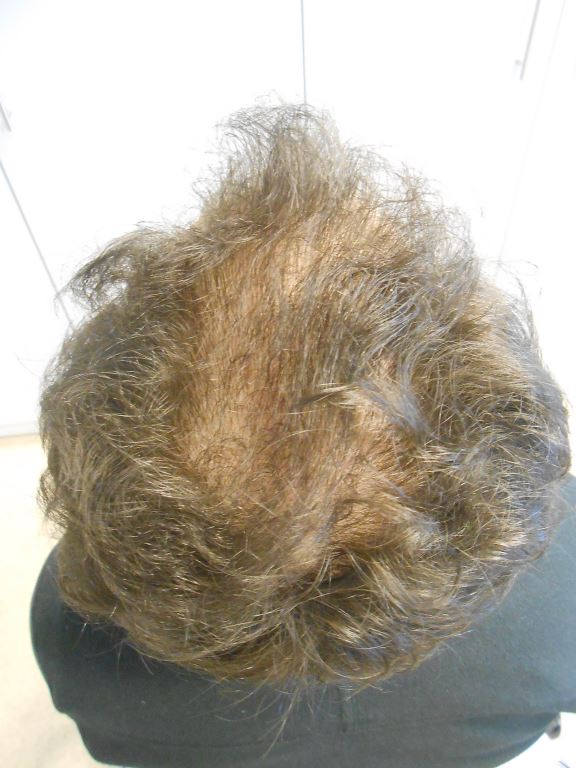 /foren/transplant/index.php/fa/40970/0/