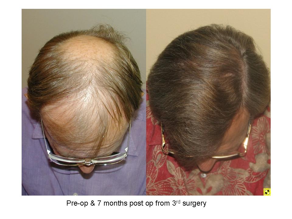 index.php/fa/4099/0/