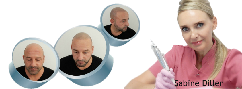 /foren/transplant/index.php/fa/41060/0/