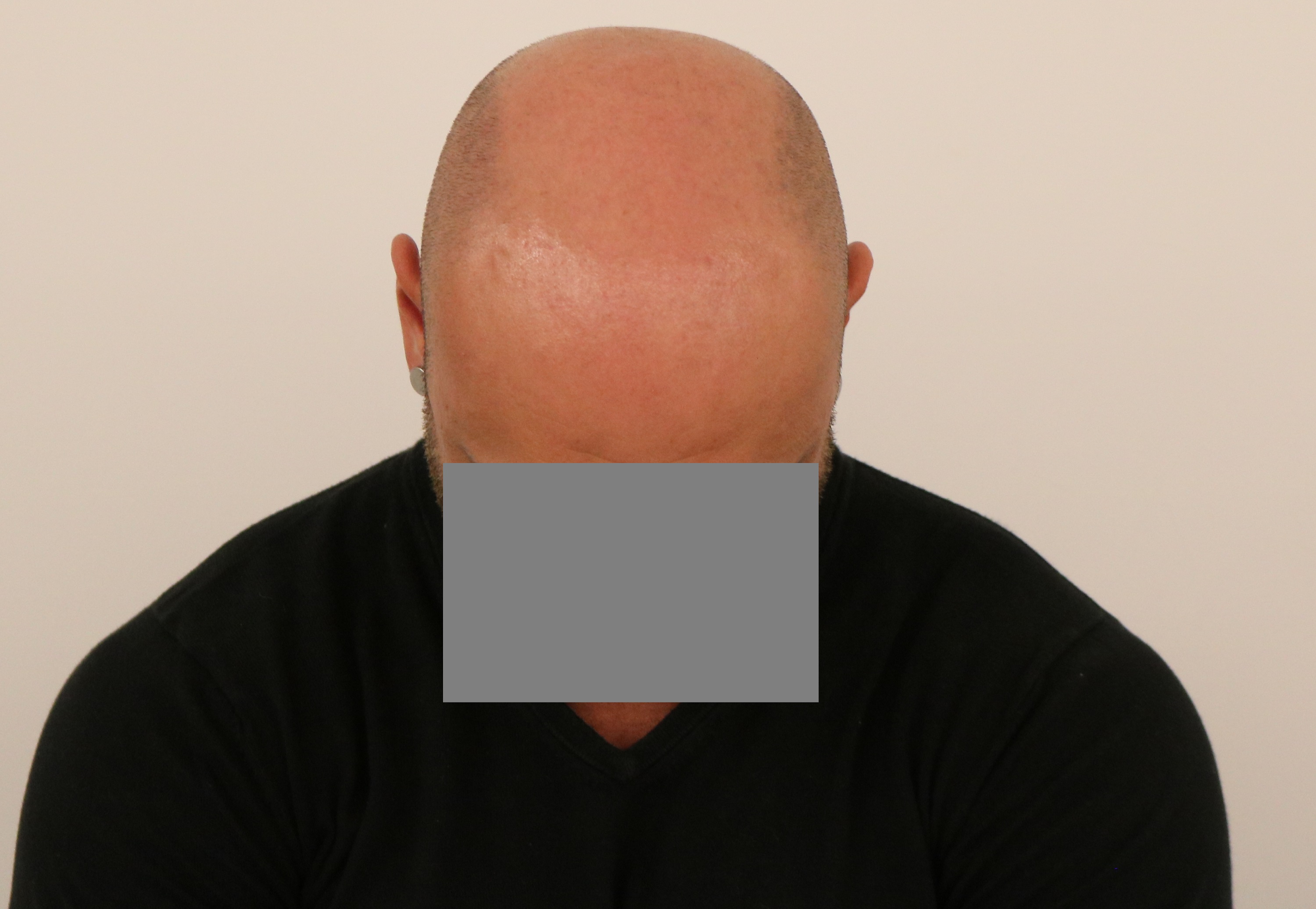 /foren/transplant/index.php/fa/41079/0/