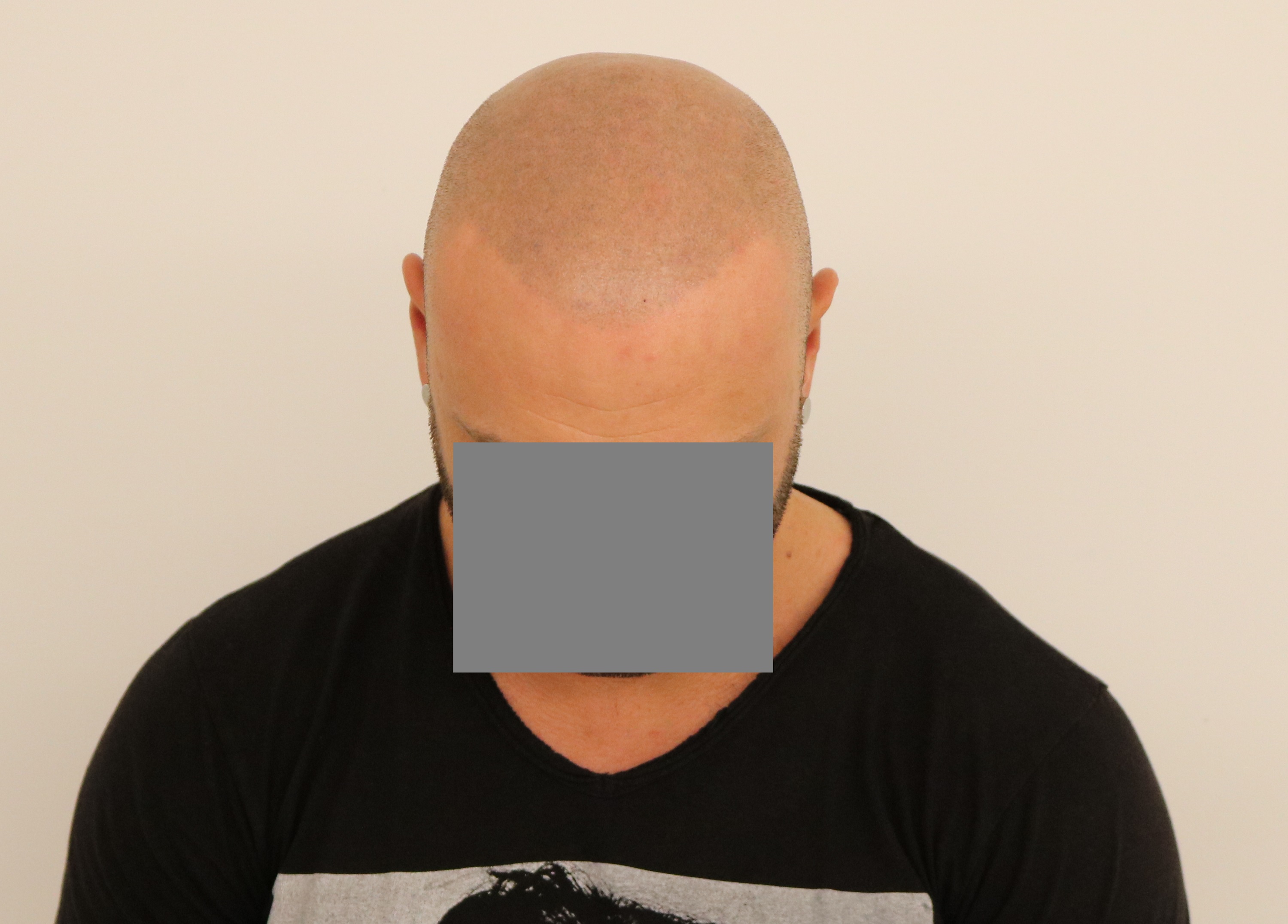 /foren/transplant/index.php/fa/41080/0/