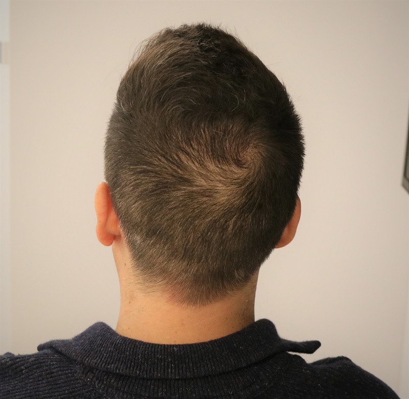 /foren/transplant/index.php/fa/41167/0/