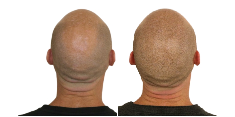 /foren/transplant/index.php/fa/41392/0/