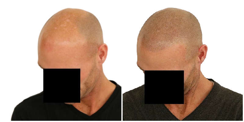 /foren/transplant/index.php/fa/41393/0/