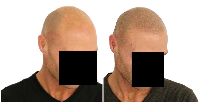 /foren/transplant/index.php/fa/41394/0/