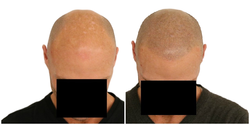 /foren/transplant/index.php/fa/41395/0/