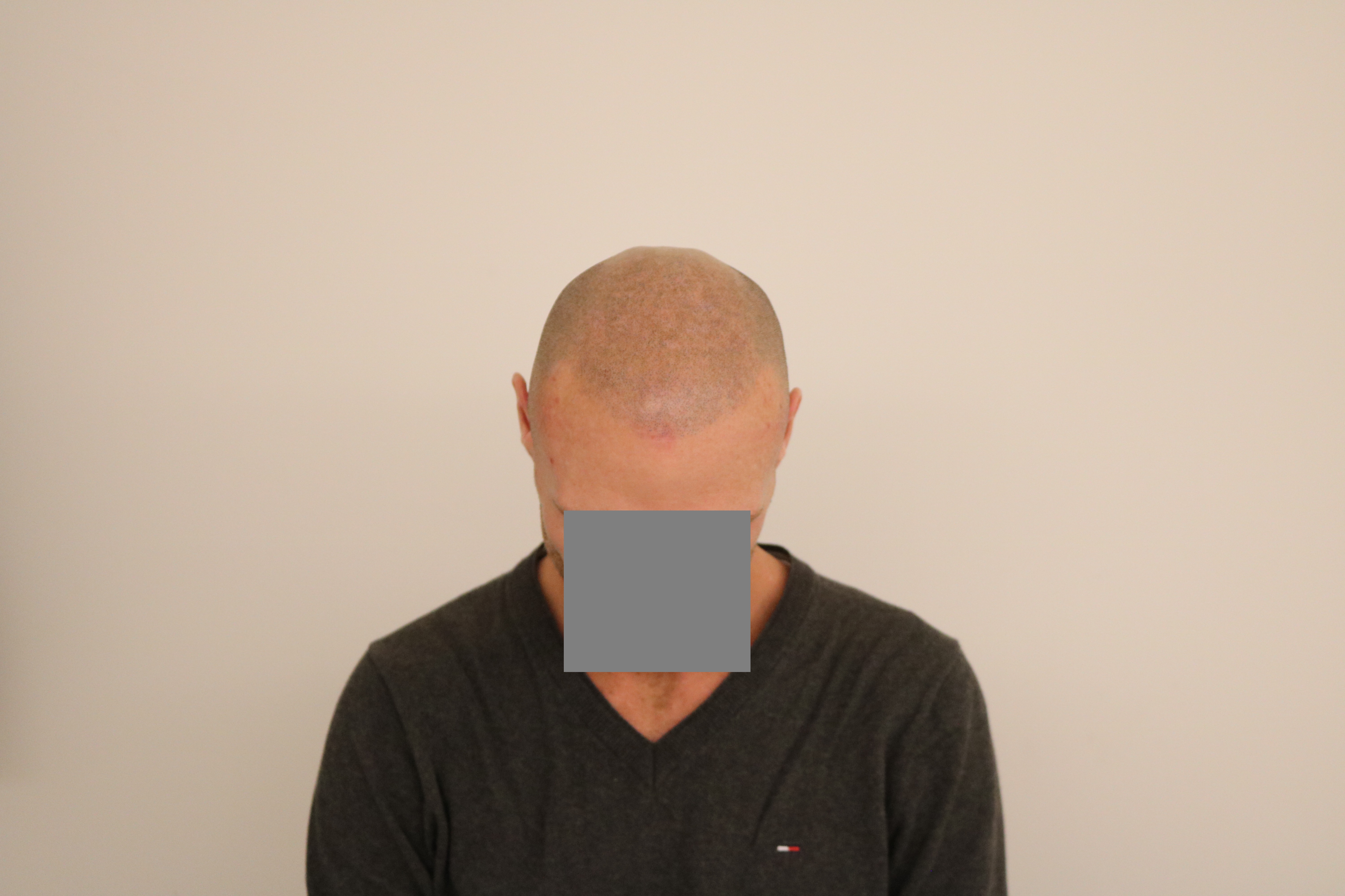 /foren/transplant/index.php/fa/41399/0/