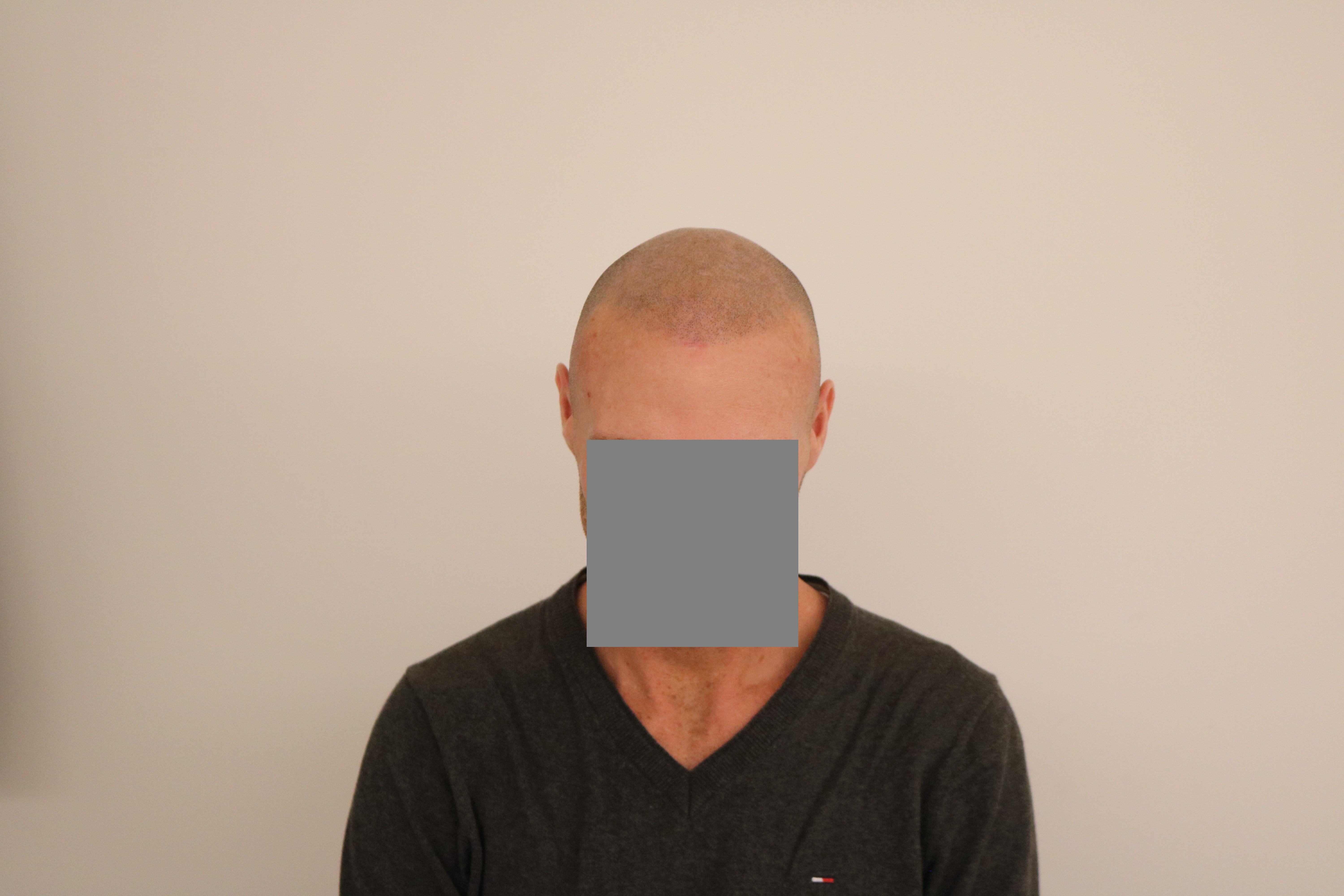 /foren/transplant/index.php/fa/41402/0/