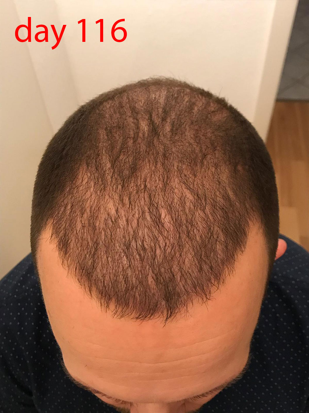 /foren/transplant/index.php/fa/41482/0/