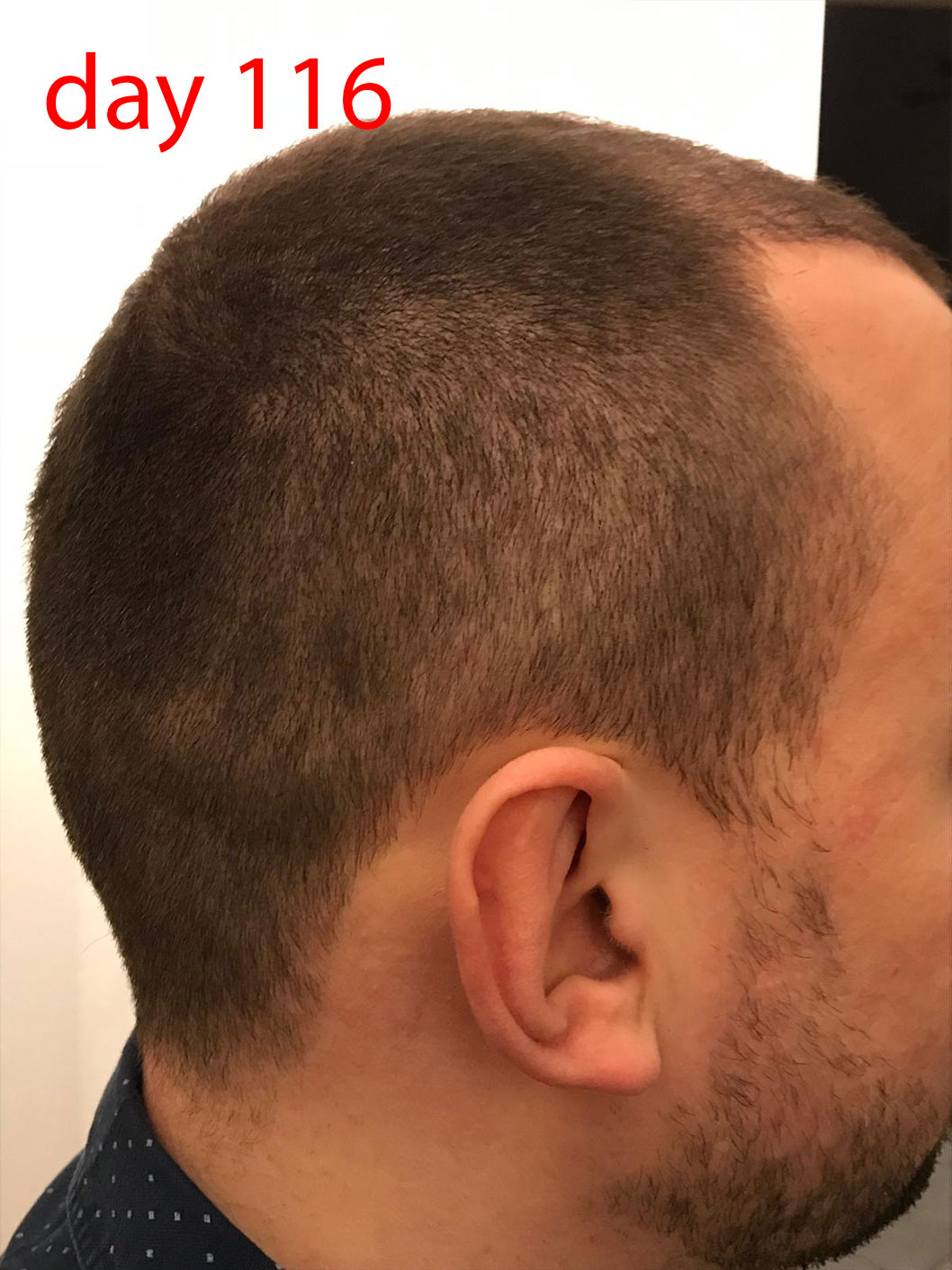 /foren/transplant/index.php/fa/41483/0/