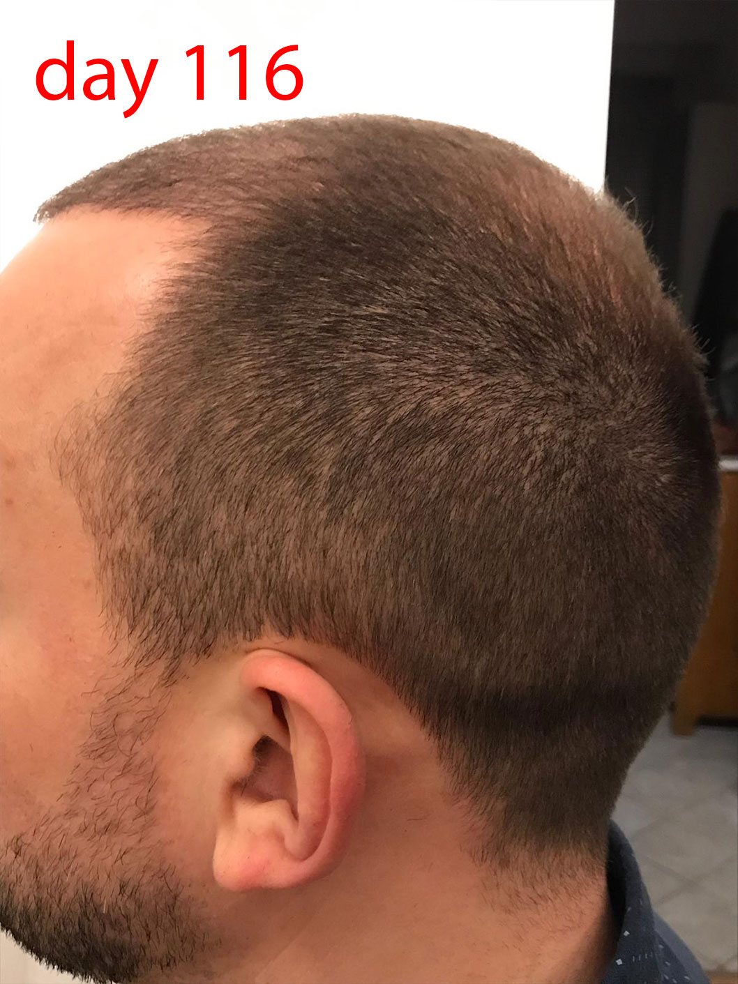 /foren/transplant/index.php/fa/41485/0/