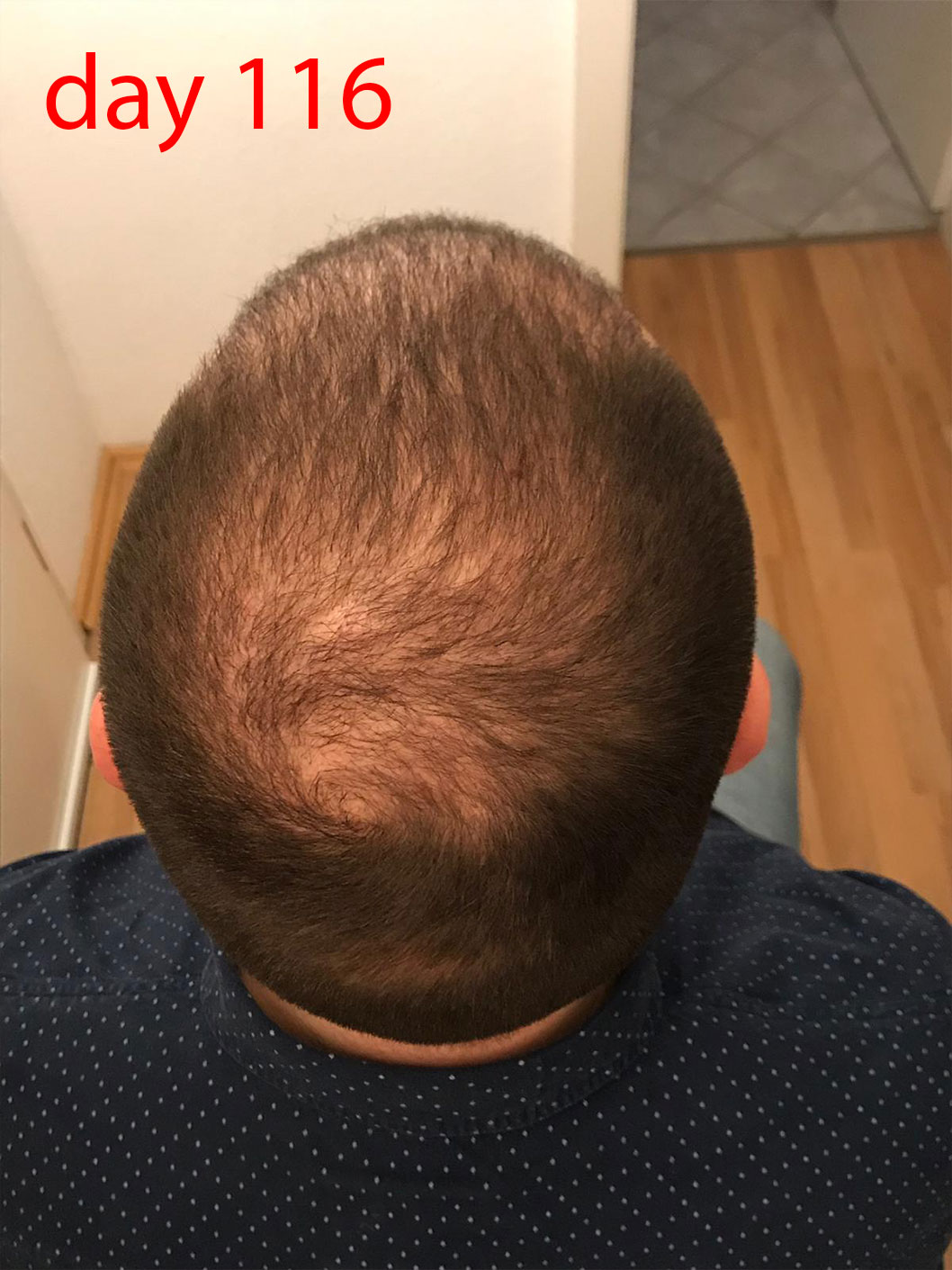 /foren/transplant/index.php/fa/41486/0/