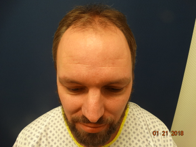 /foren/transplant/index.php/fa/41677/0/