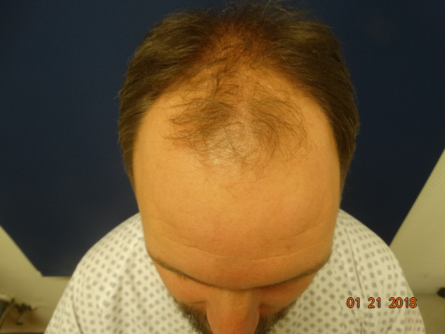 /foren/transplant/index.php/fa/41679/0/