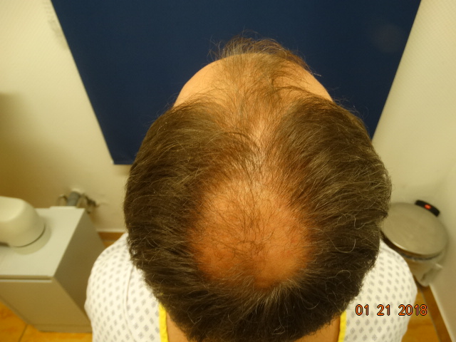 /foren/transplant/index.php/fa/41683/0/