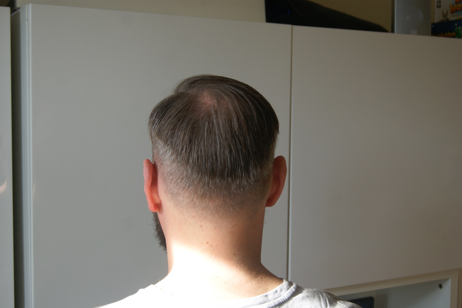 /foren/transplant/index.php/fa/41684/0/