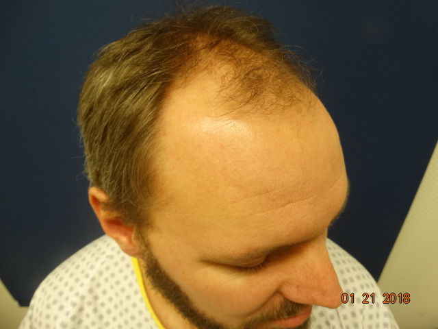 /foren/transplant/index.php/fa/41685/0/