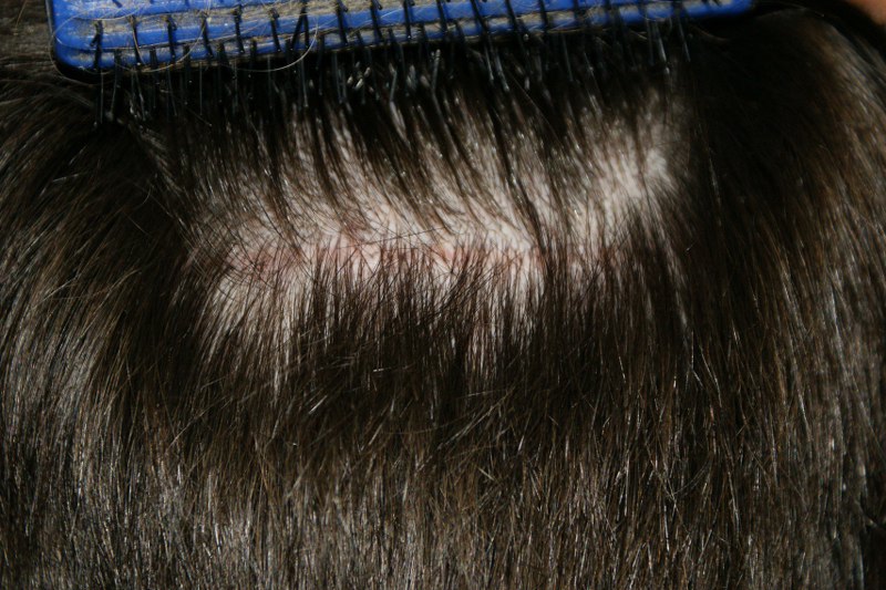 index.php/fa/4171/0/