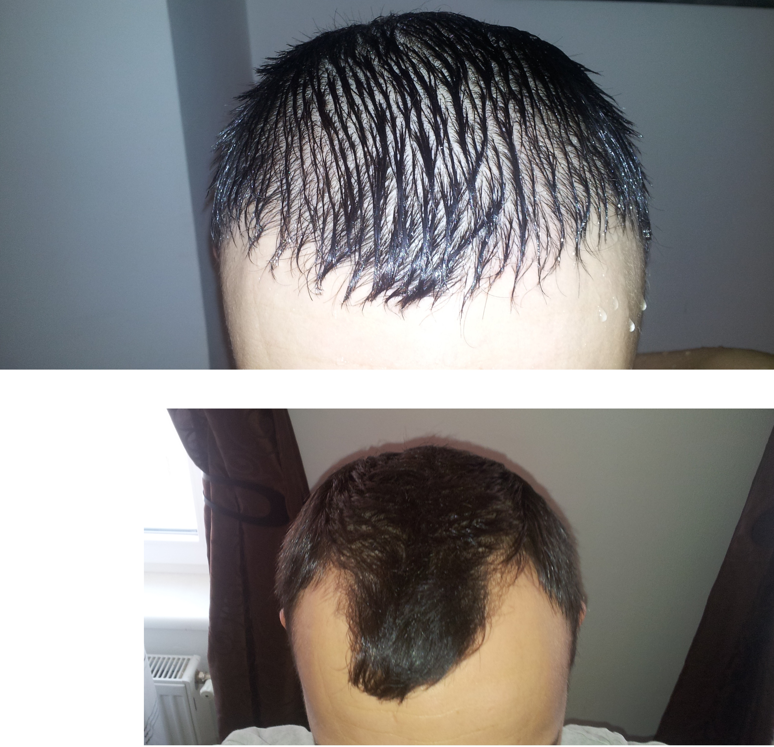 /foren/transplant/index.php/fa/41795/0/