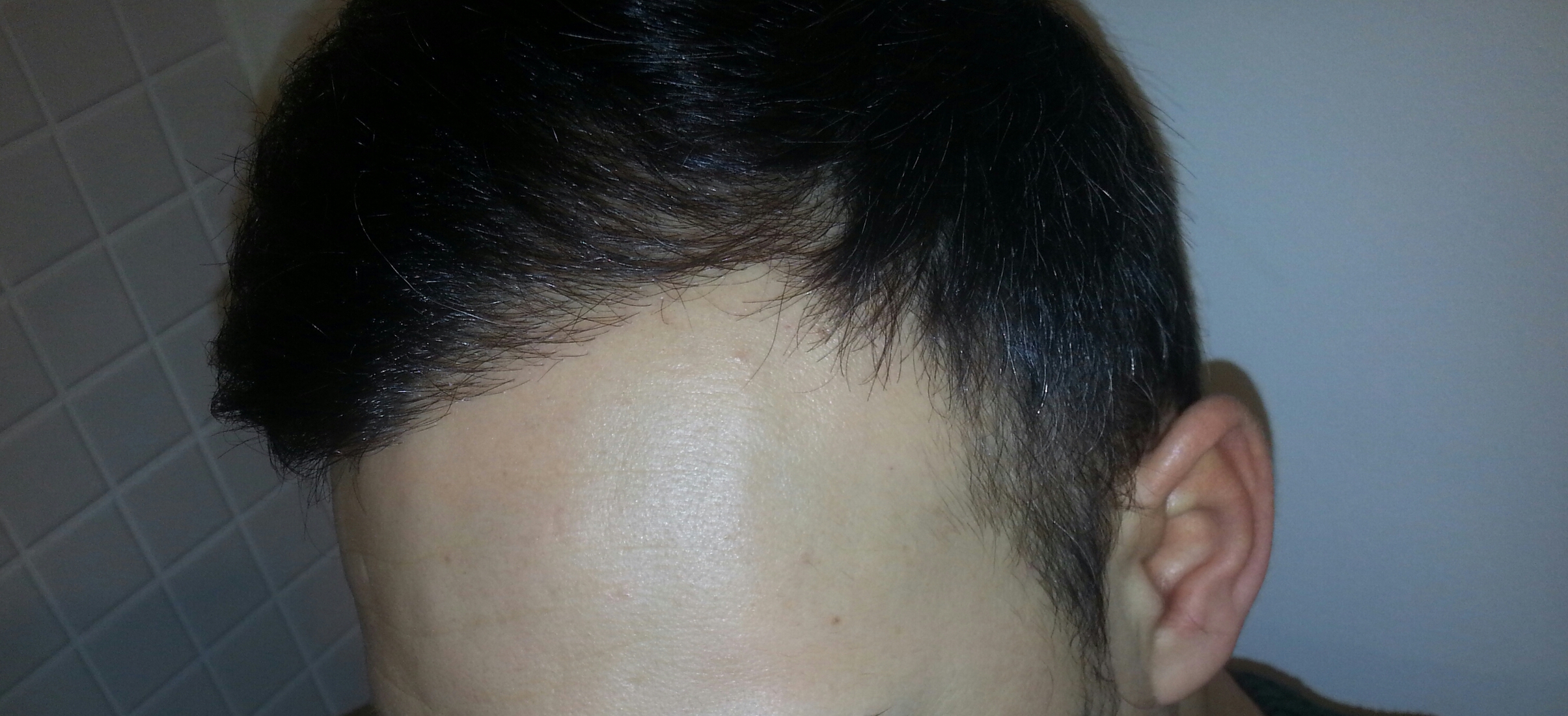 /foren/transplant/index.php/fa/41797/0/