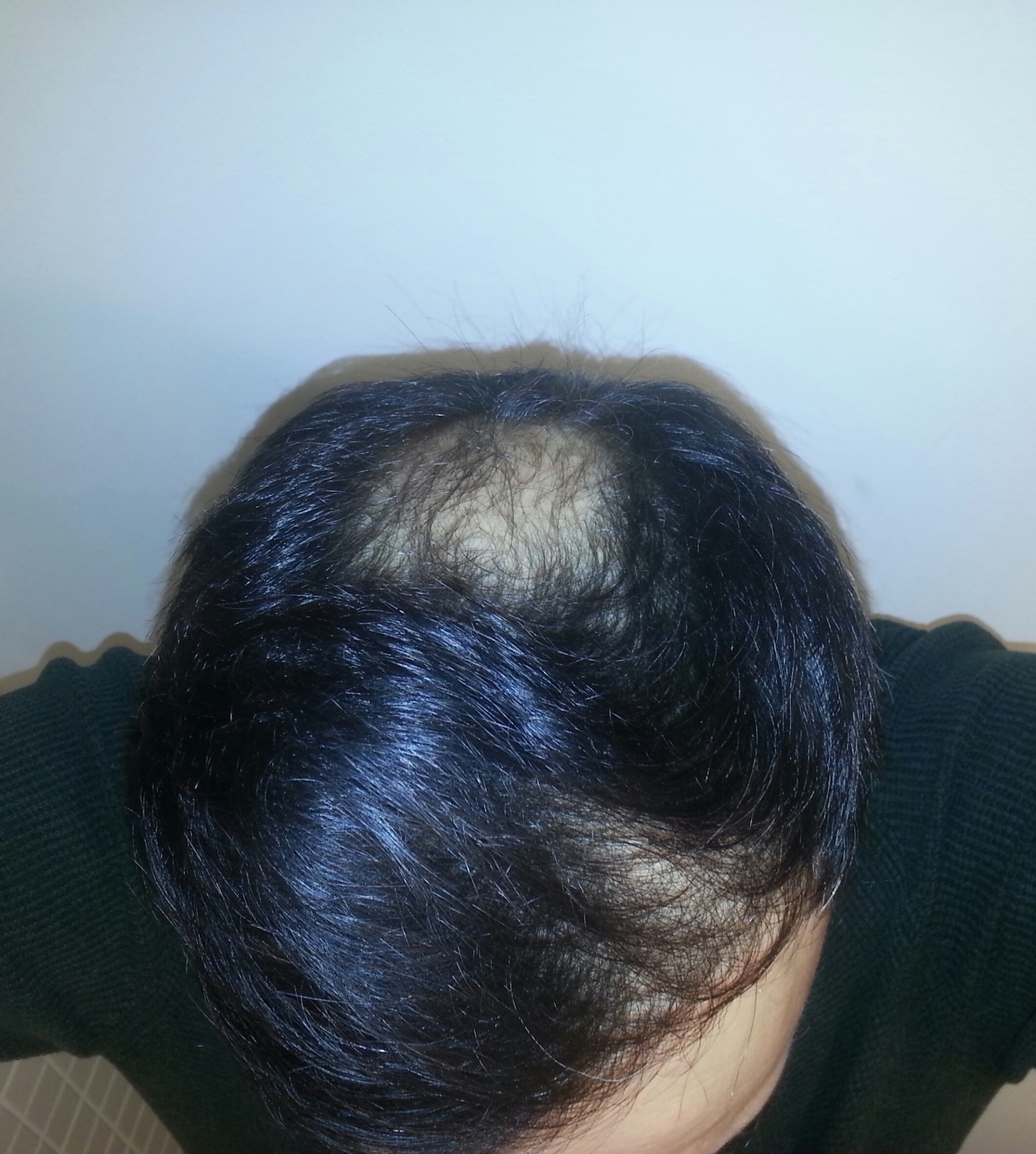 /foren/transplant/index.php/fa/41798/0/