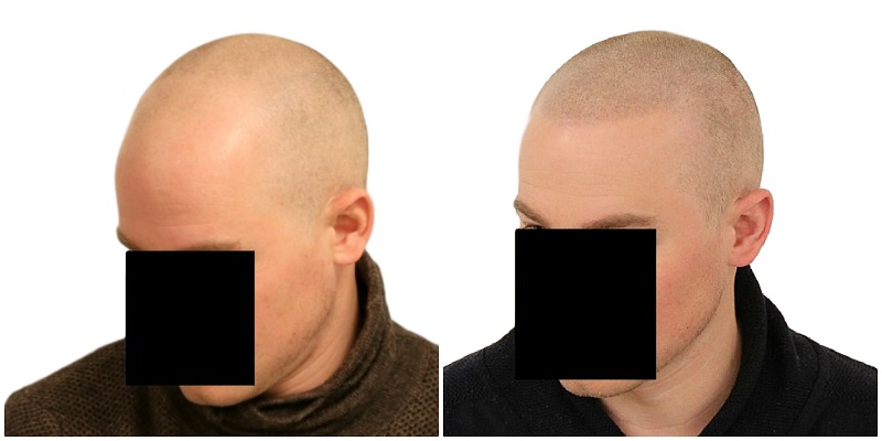 /foren/transplant/index.php/fa/41858/0/