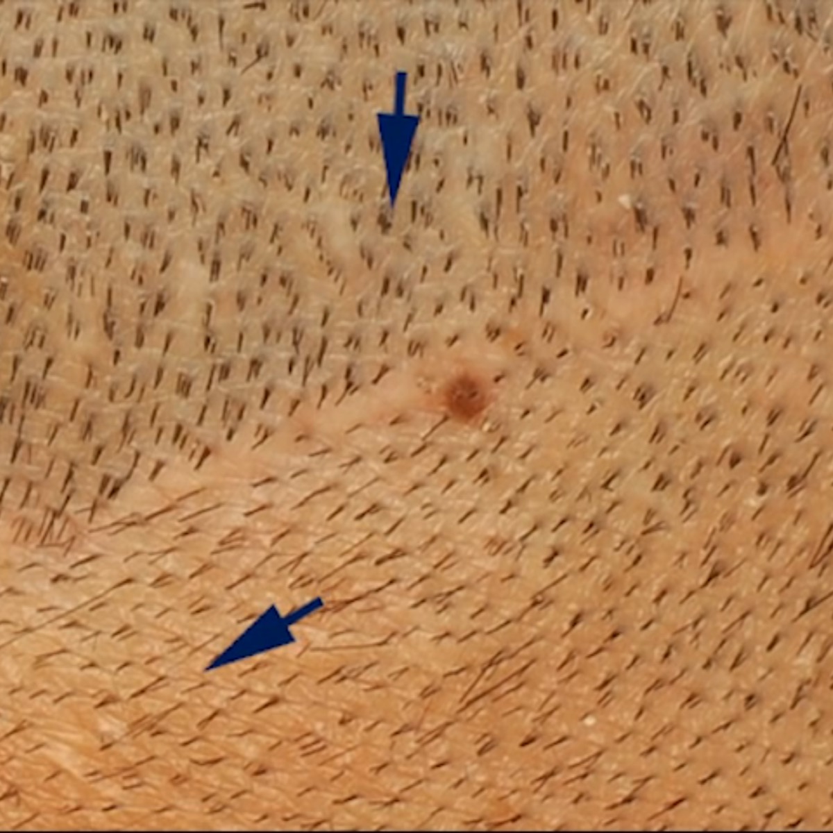 /foren/transplant/index.php/fa/41912/0/