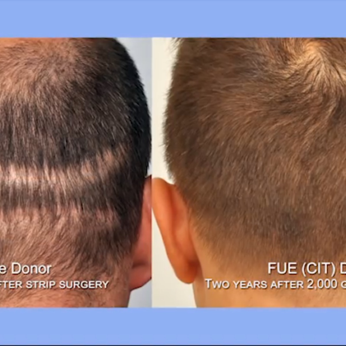 /foren/transplant/index.php/fa/41913/0/