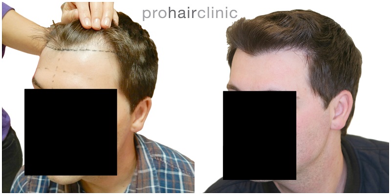 /foren/transplant/index.php/fa/41954/0/