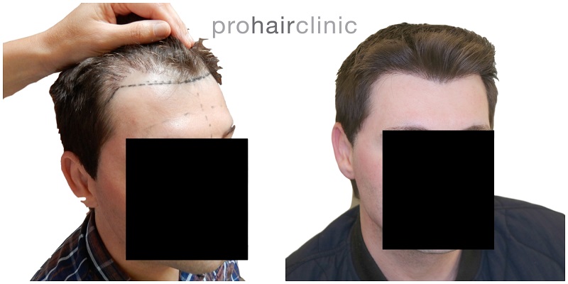 /foren/transplant/index.php/fa/41955/0/