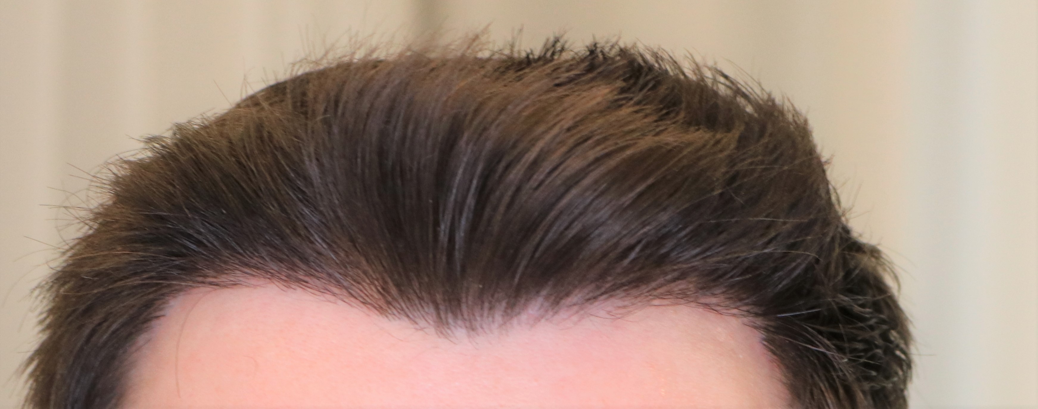 /foren/transplant/index.php/fa/41957/0/