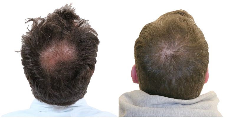 /foren/transplant/index.php/fa/41984/0/