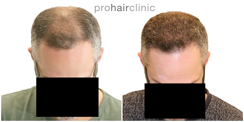 /foren/transplant/index.php/fa/42025/0/