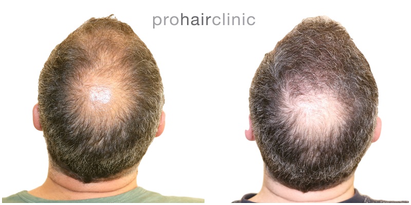 /foren/transplant/index.php/fa/42026/0/