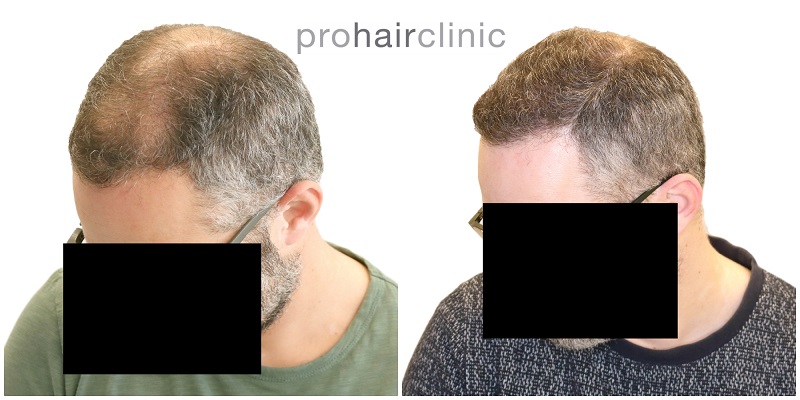 /foren/transplant/index.php/fa/42027/0/