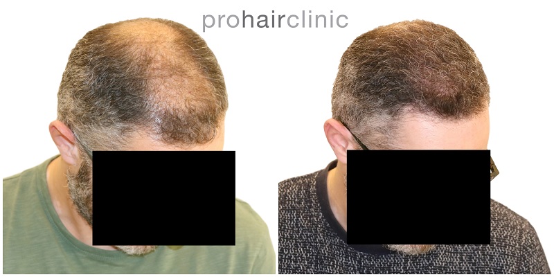 /foren/transplant/index.php/fa/42028/0/