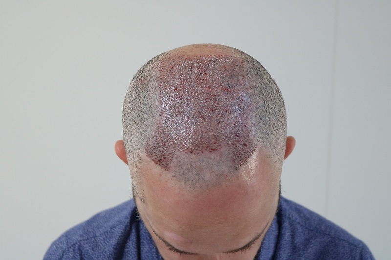 /foren/transplant/index.php/fa/42029/0/