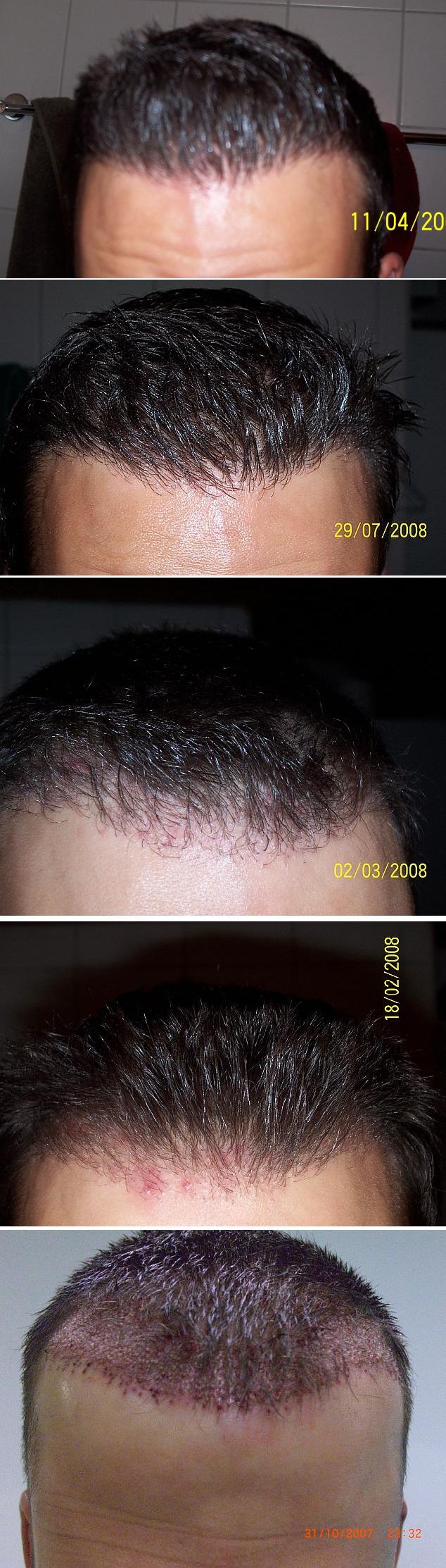 index.php/fa/4206/0/